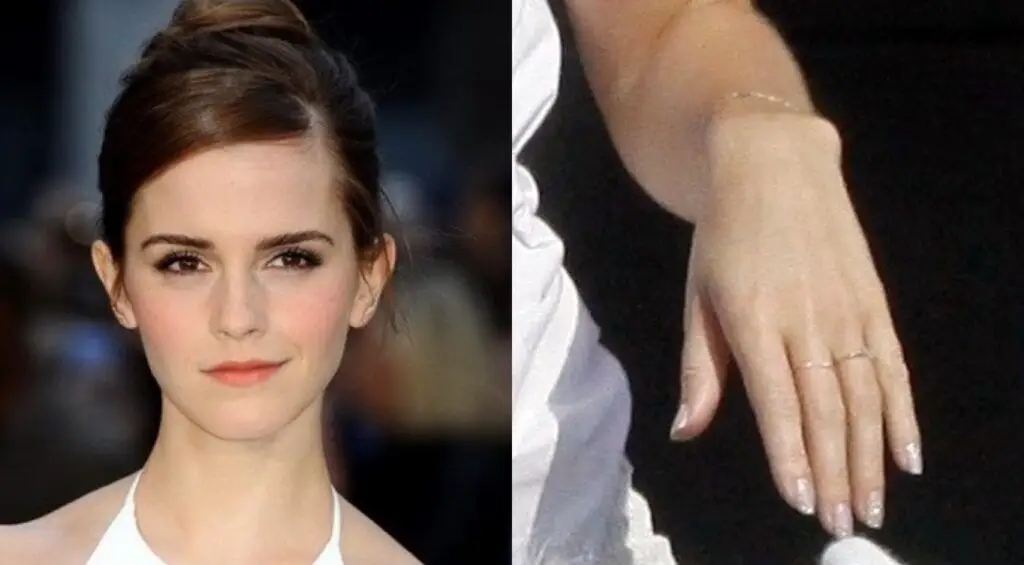 Emma Watson đã đính hôn